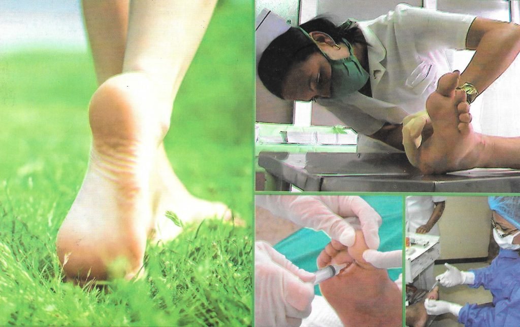 Treatment Of Diabetic Foot With Heberprot P ® Cubanidad Limited